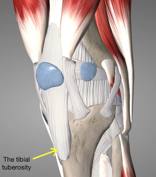 Osgood Schlatters cause of the pain